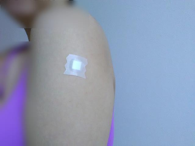 ワクチン接種後の腕
